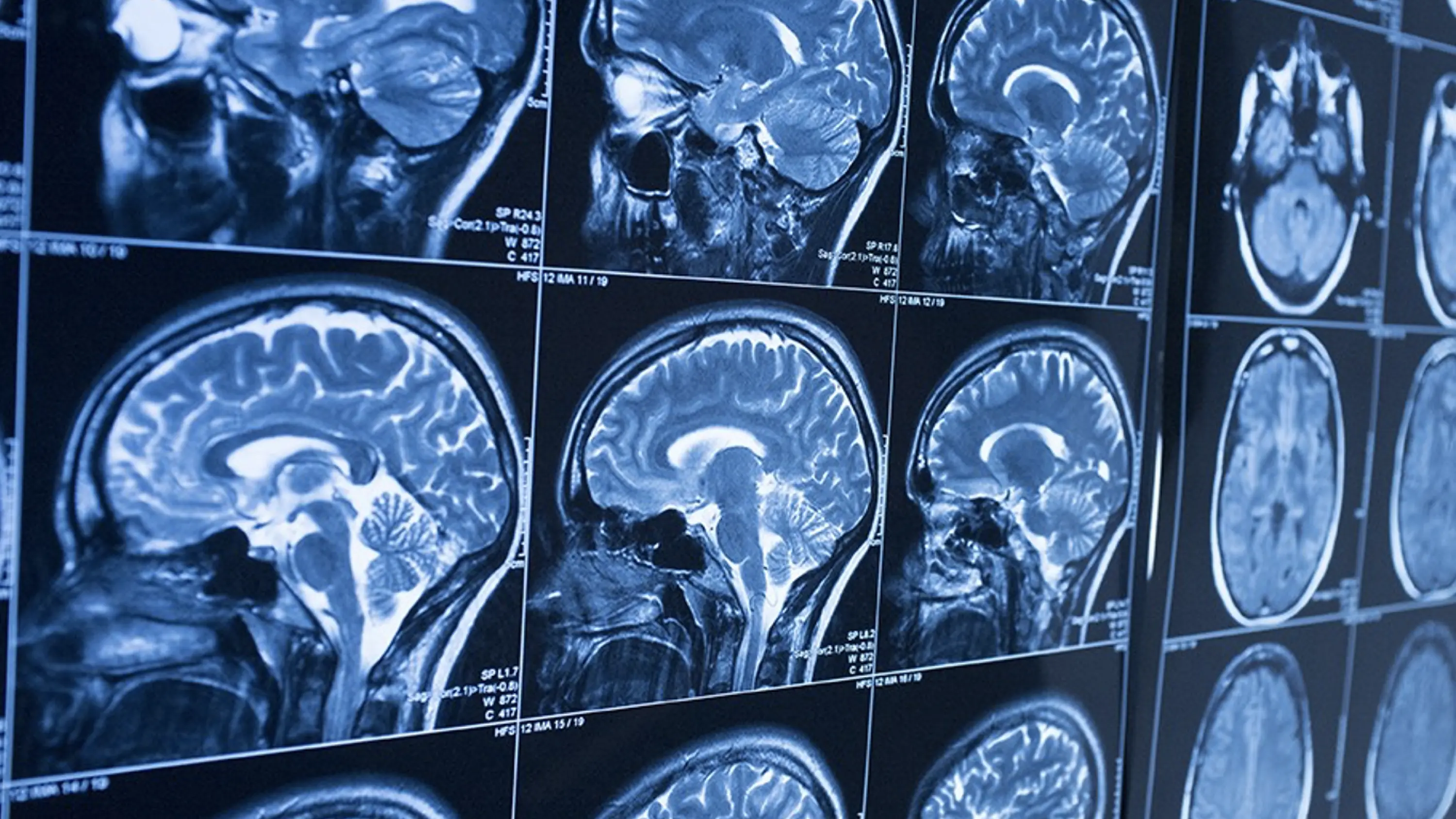 Интерпретация КТ-исследований